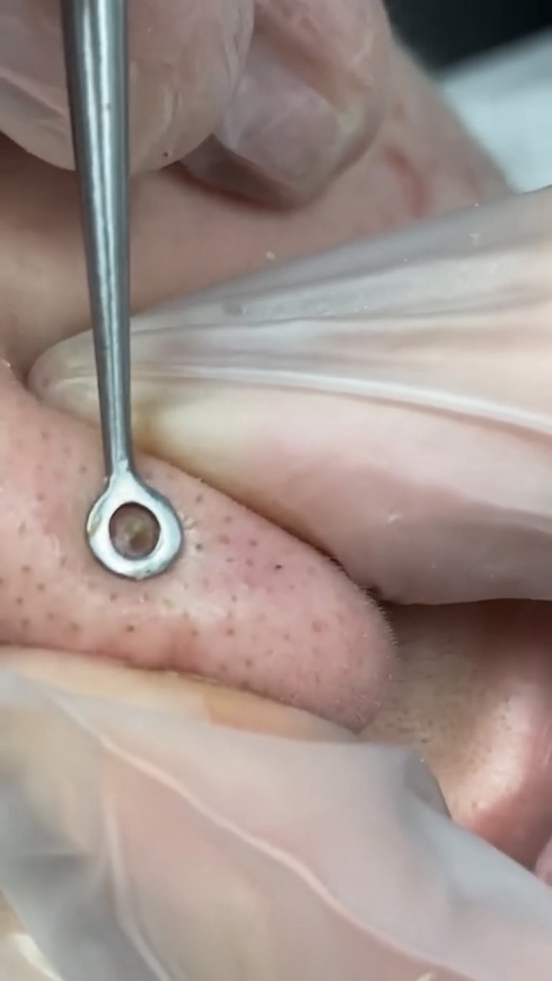 Satisfying Whitehead