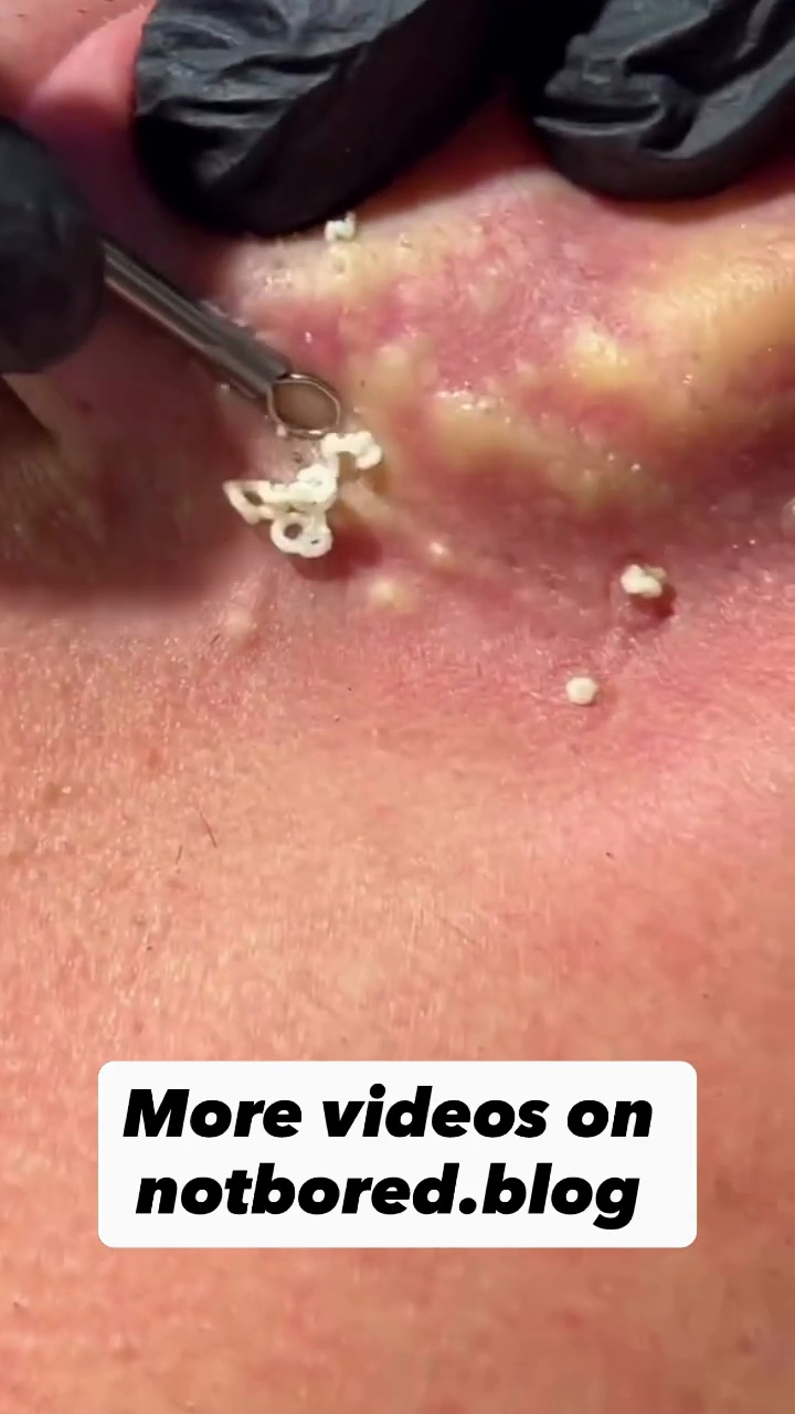 Two Satisfying Popping Videos